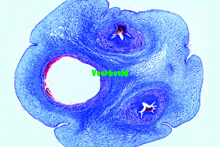 Umbilical cord, human, t.s.