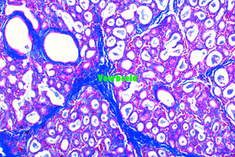 Mammary gland, human, sec.