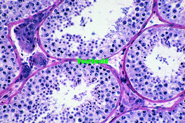 Testis, human, t.s.