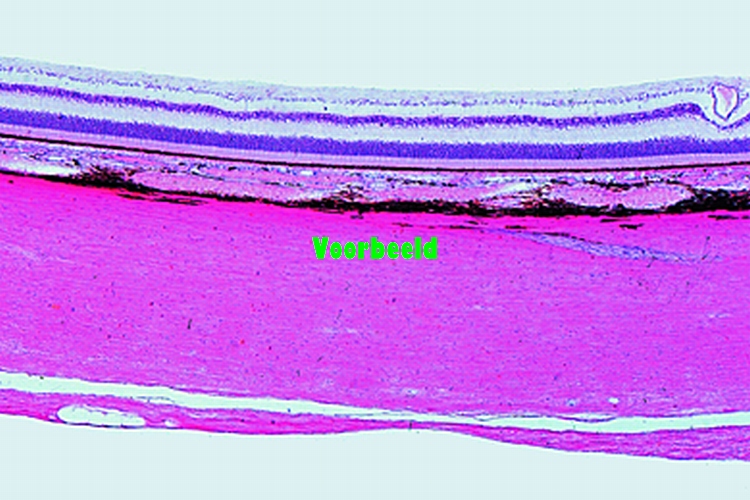 Retina, human, t.s.