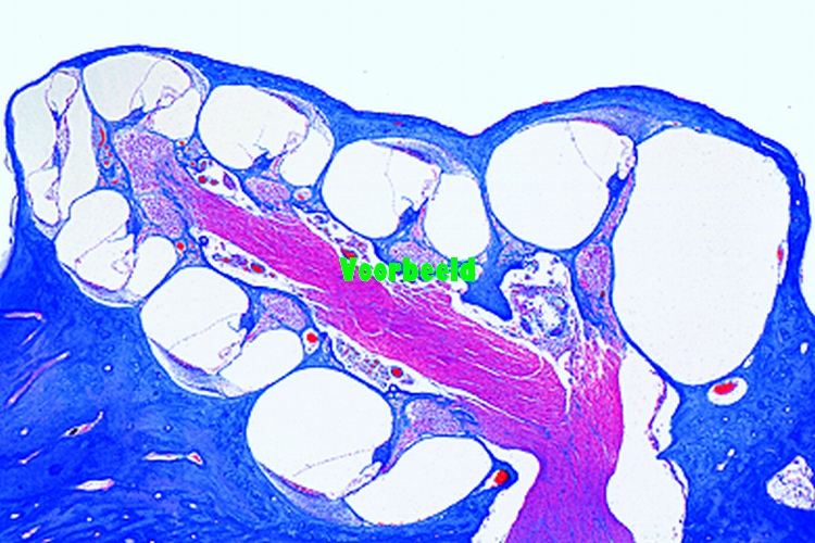 Internal ear, human foetal, t.s.
