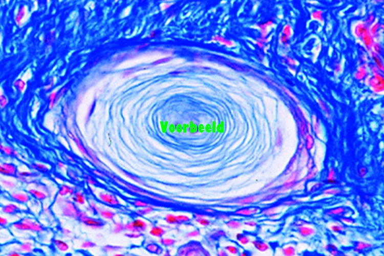 Touch corpuscles in human skin, t.s.