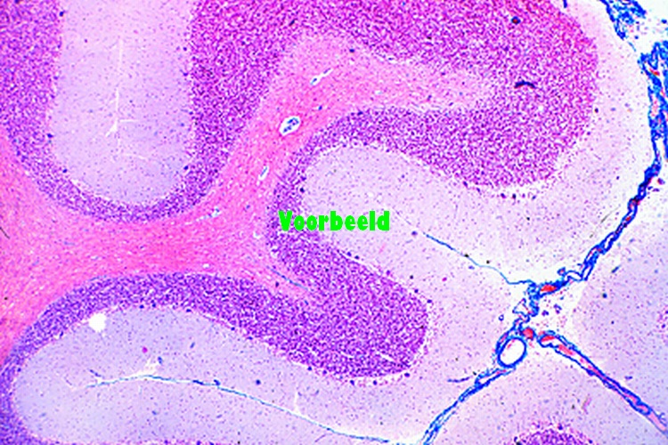 Cerebellum, human, t.s.