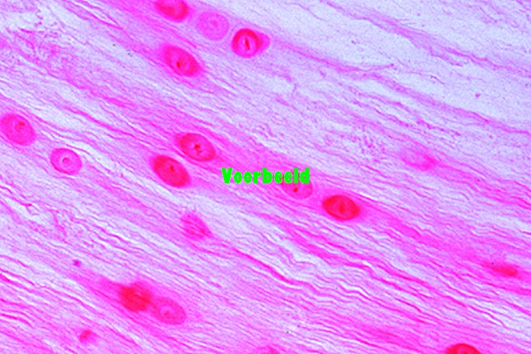White fibrous cartilage, human intervert