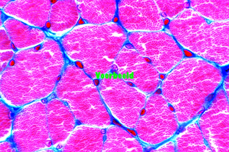 Striated (skeletal) muscle, human t.s.