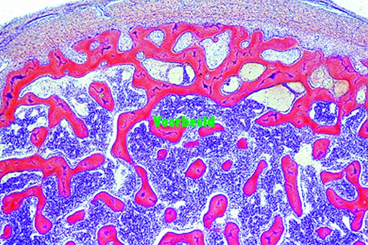 Spongy (cancellous) bone, human t.s.