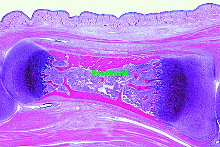 Bone development (intracartilaginous), l