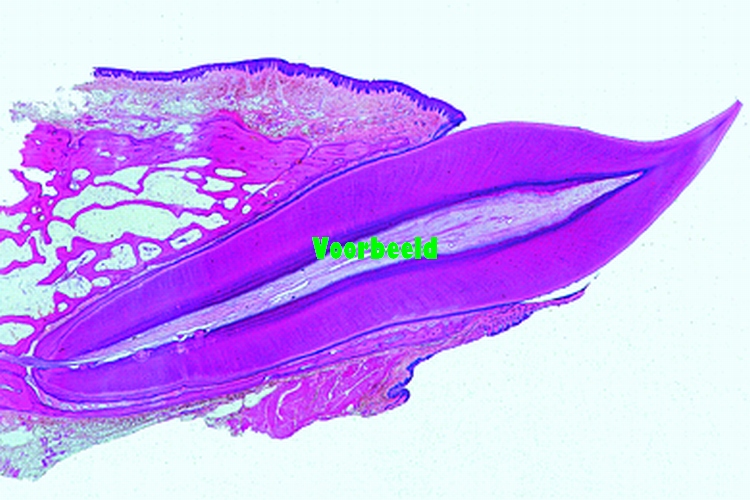 Tooth, human, complete l.s.