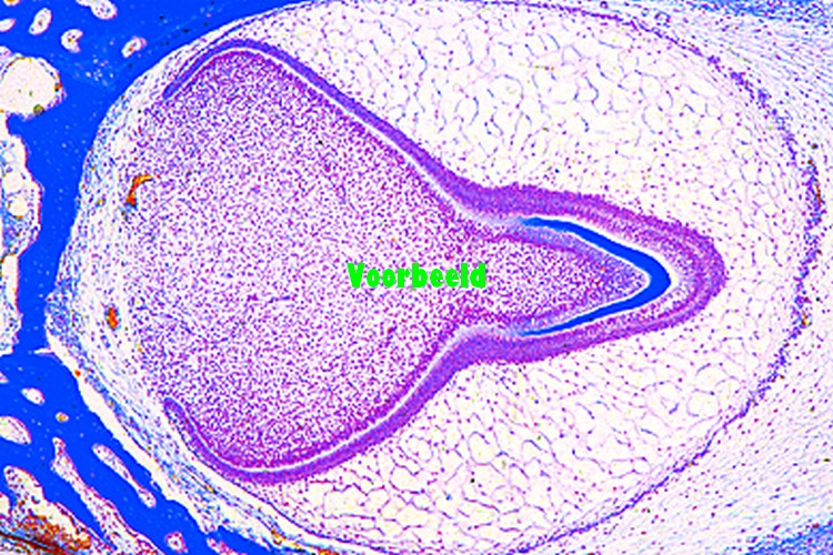 Tooth development from human foetus, med