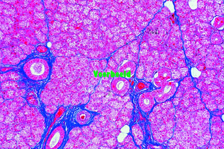Parotid gland (Gl. parotis), human t.s.