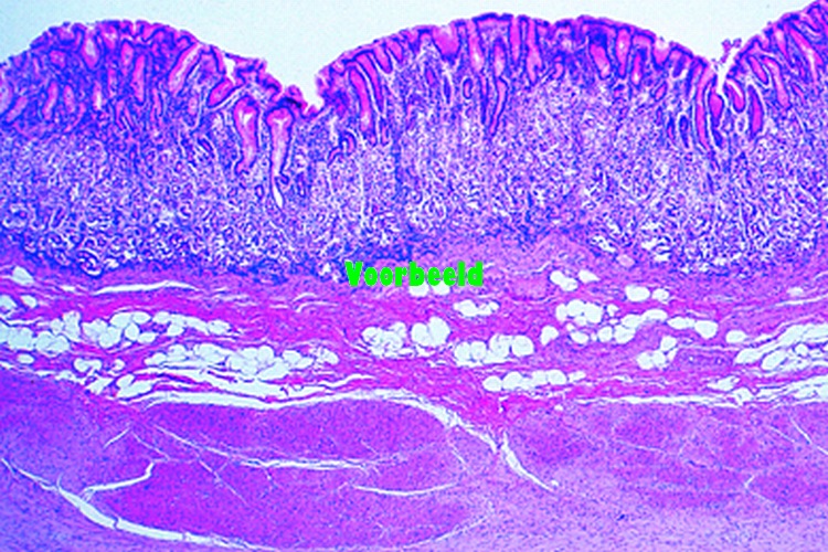 Stomach, fundic region, human t.s.