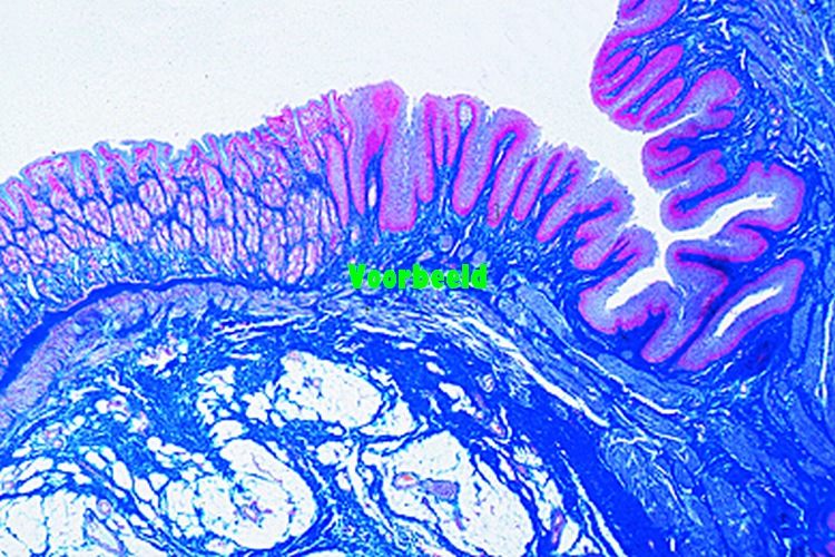 Stomach, cardiac region, human t.s.