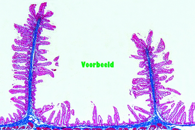 Jejunum, human t.s.