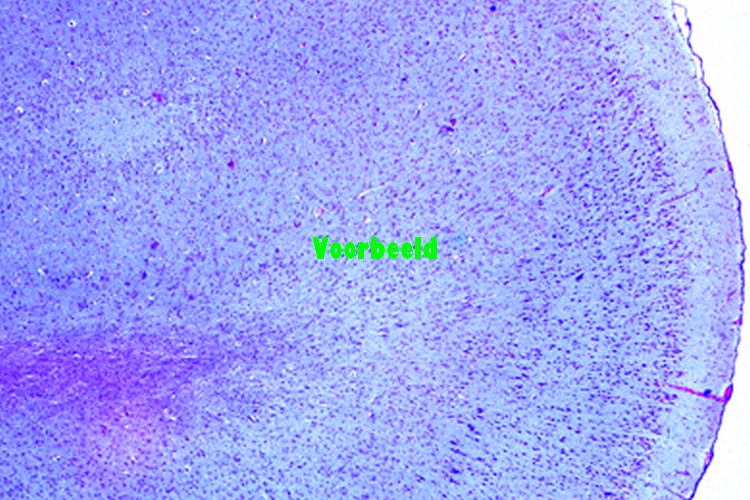 Cerebral cortex, human, t.s. stained for