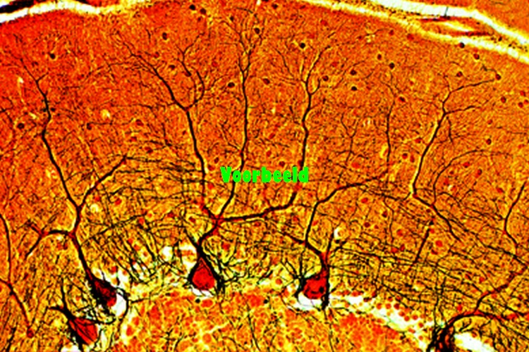 Cerebellum, human, t.s. silvered (Golgi