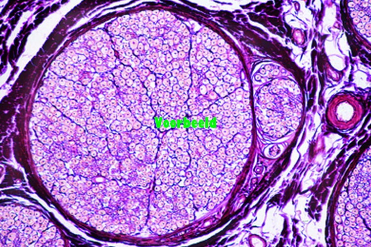 Peripheral nerve, human t.s.