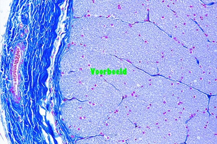 Optic nerve, human t.s.