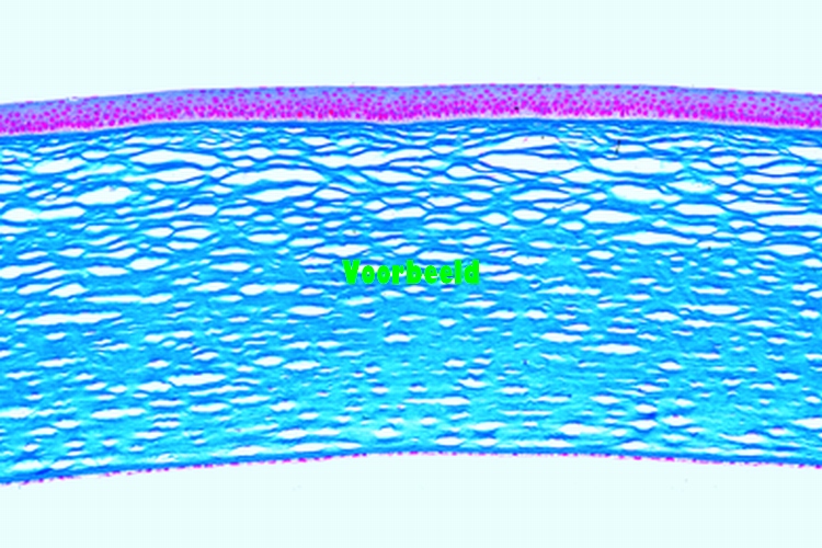 Cornea from eye, human t.s.