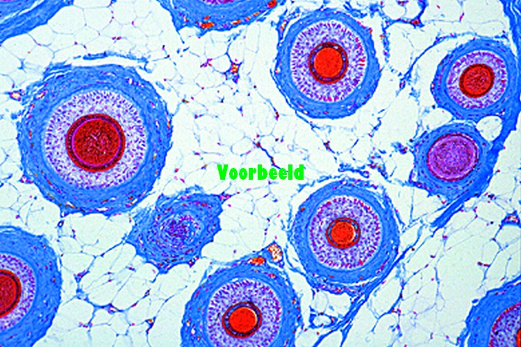 Scalp, human, horizontal l.s. shows t.s.
