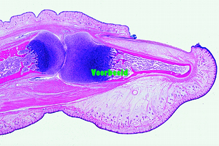 Nail development, sagittal l.s. finger t