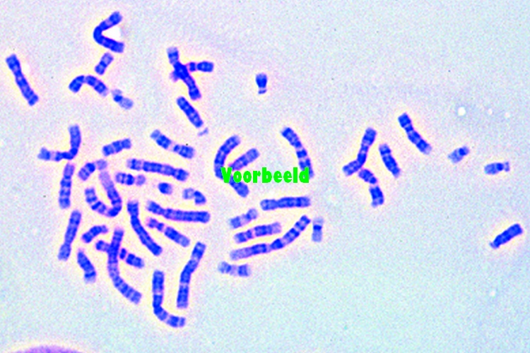Human chromosomes in smear from culture