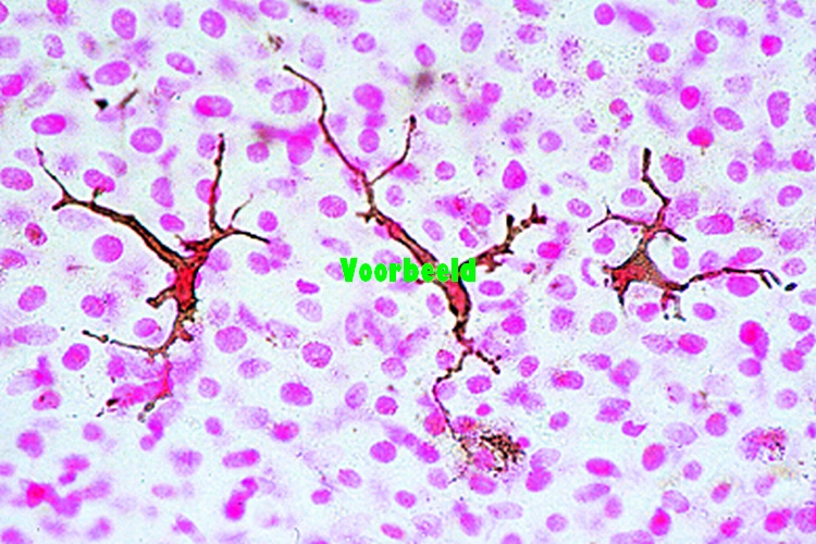 Pigment cells in skin