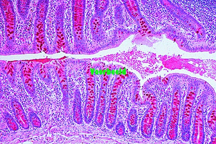 Goblet cells in sec. of colon, stained w