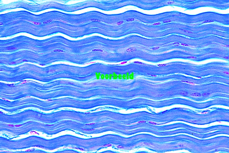 White fibrous tissue, l.s. of tendon