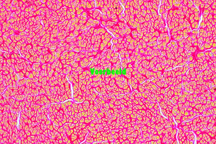 Yellow elastic fibrous tissue, t.s. of L
