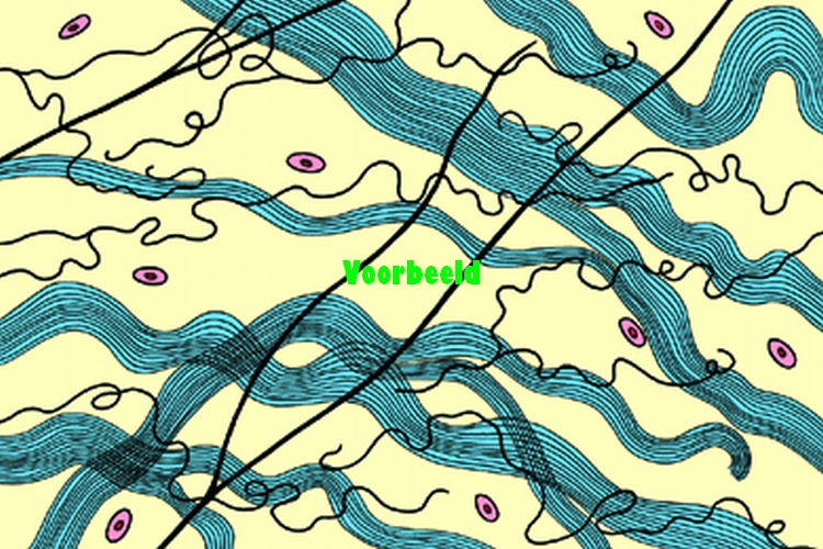 Elastic tissue, fibres teased and w.m.