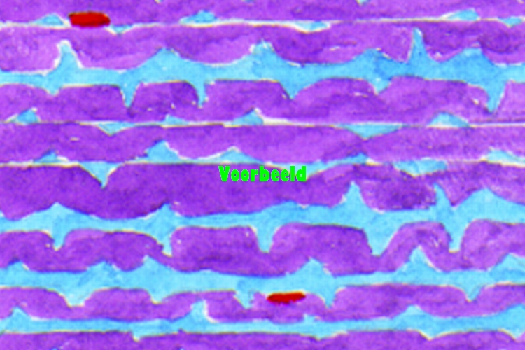 Yellow elastic fibrous tissue, l.s. of L