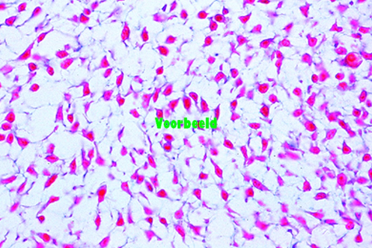Embryonic connective tissue t.s.