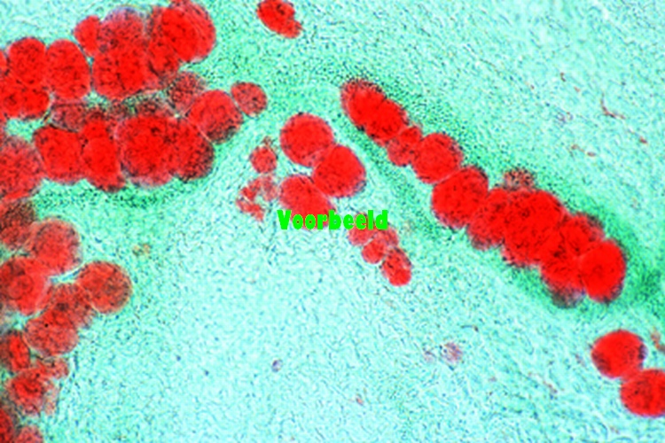 Adipose tissue, section showing fat in s