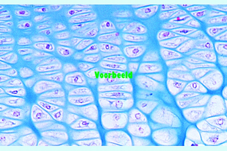 Fetal hyaline cartilage, t.s.