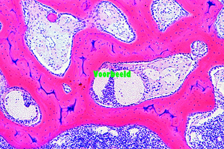 Cancellous (spongy) bone, t.s.