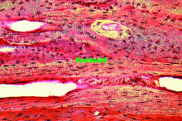 Compact bone, l.s. specially prepared to