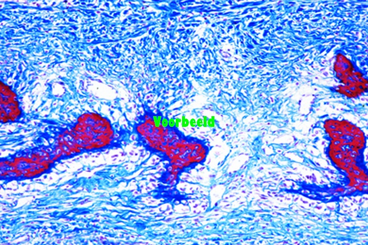 Bone development, intermembranous ossifi