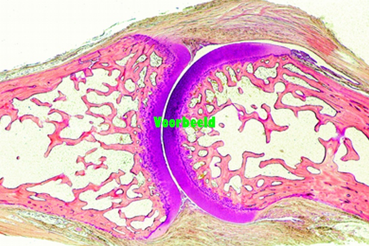 Joint of finger or toe, sagittal l.s.