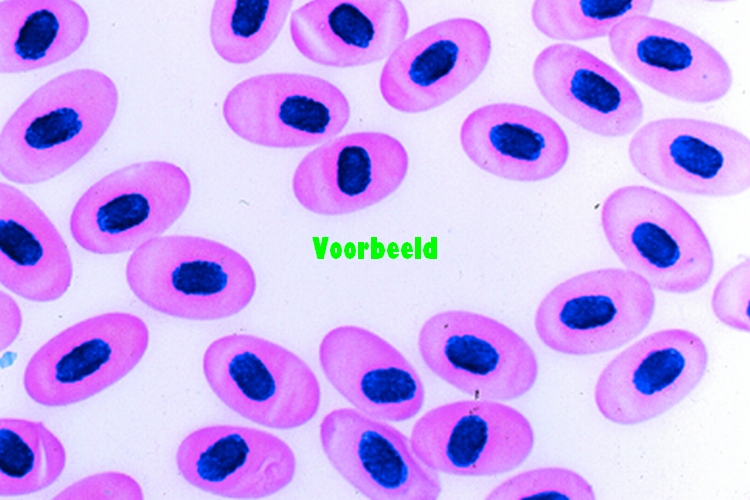 Salamandra, blood smear