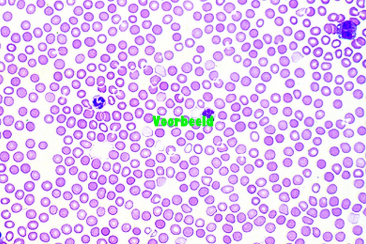 Rabbit blood smear, Giemsa stain