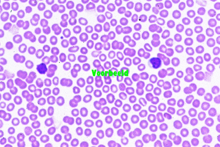 Rat blood smear, Giemsa stain
