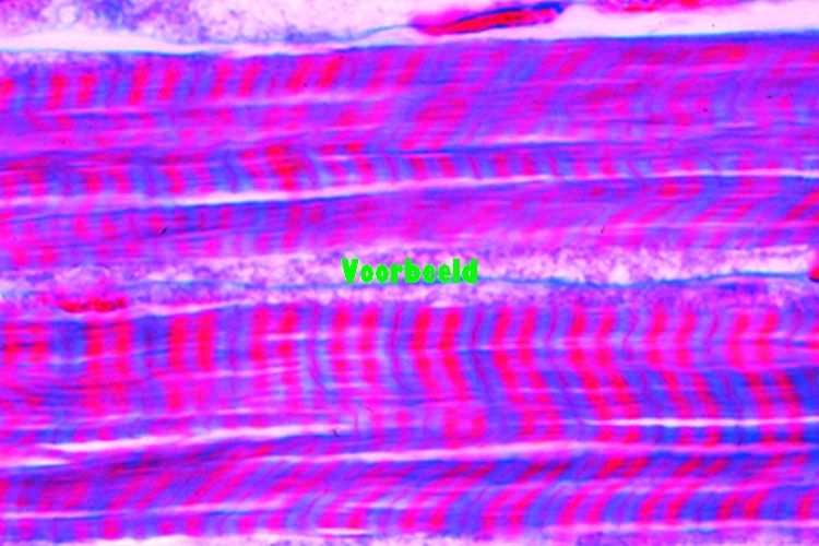 Striated (skeletal) muscle, thin l.s. sp