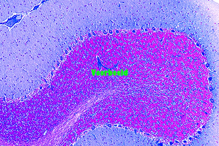 Cerebellum of cat or dog, t.s. routine s