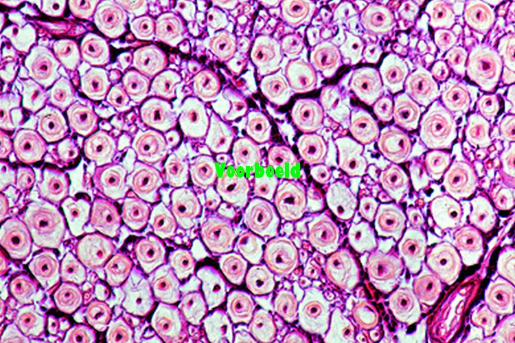 Peripheral nerve of cow or pig, l.s. rou