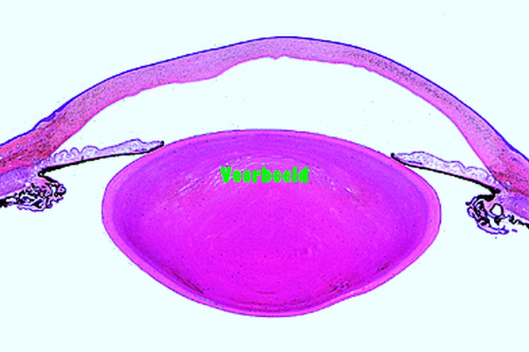 Eye of cat, anterior part with iris, cil