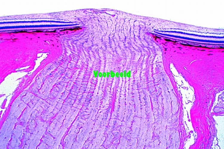 Retina of pig, sec. with entrance of opt