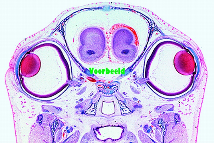 Developing eyes in t.s. of head from gui