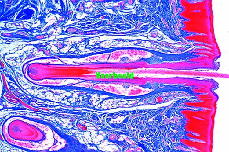 Tactile hairs with blood sinus, l.s. or