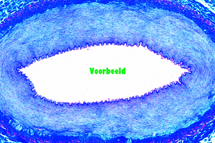 Artery of rabbit, t.s. routine stained