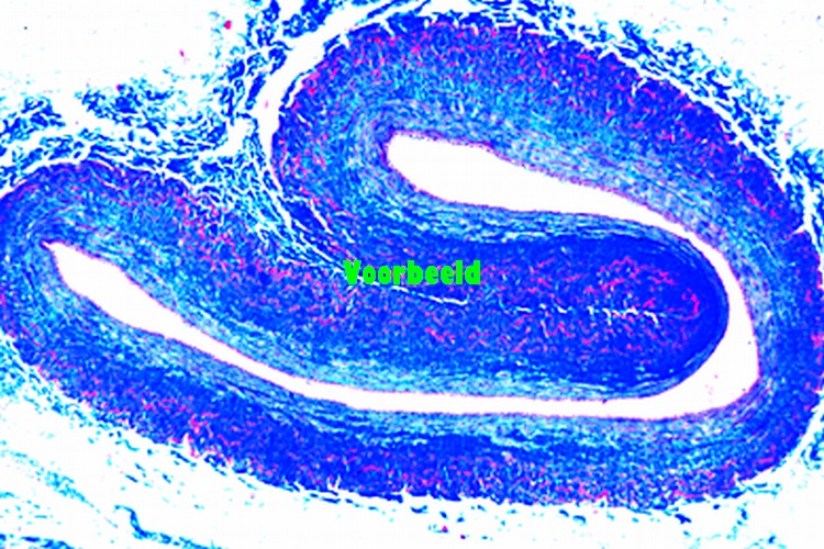Vein of rabbit, t.s. routine stained